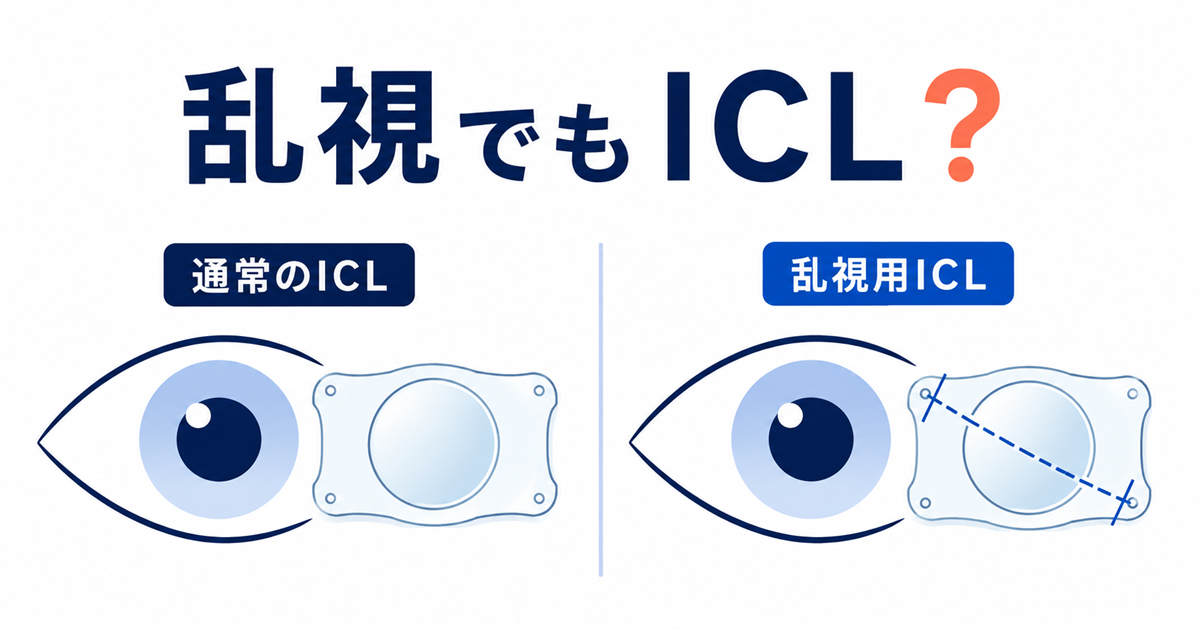 通常のICLと乱視用ICLのレンズを並べた図解。乱視用レンズには乱視の軸を示す破線が入っている