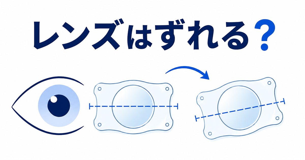 乱視用ICLのレンズが眼内で回転する様子を示した図解。回転の前後で乱視の軸を示す破線の向きが変わっている